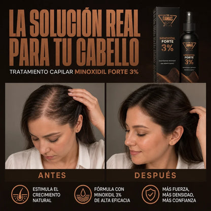 Minoxidil Forte 3% Para Damas